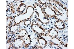 Immunohistochemical staining of paraffin-embedded Kidney tissue using anti-PSMC3mouse monoclonal antibody. (PSMC3 抗体)