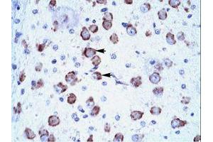 Image no. 1 for anti-Mediator Complex Subunit 17 (MED17) (AA 156-205) antibody (ABIN6735876) (MED17 抗体  (AA 156-205))