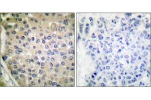 Immunohistochemistry (IHC) image for anti-Protein Phosphatase 1, Regulatory (Inhibitor) Subunit 14A (PPP1R14A) (AA 5-54), (pThr38) antibody (ABIN1531810)