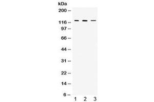 Western blot testing of 1) rat thymus, 2) mouse thymus and 3) MCF7 lysate with CIITA antibody at 0. (CIITA 抗体)