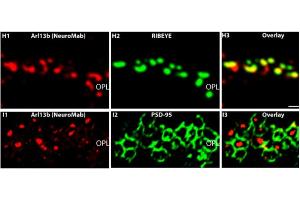 Spinning disc confocal image identifying localization of the atypical GTPase protein ARL13B (Cat (ABIN1304543), red) in primary cilium, marked by acetylated tubulin (green), in Aquaporin 2 (magenta) positive renal collecting ducts in a 24-day old mouse.