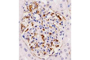 Antibody staining RHBDF2 in human kidney tissue sections by Immunohistochemistry (IHC-P - paraformaldehyde-fixed, paraffin-embedded sections). (RHBDF2 抗体  (N-Term))