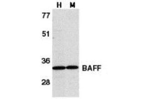 Western blot analysis of BAFF in human HL60 cell lysate (H) and mouse spleen tissue lysate (M) with AP30115PU-N BAFF antibody at 1 μg/ml. (BAFF 抗体  (C-Term))
