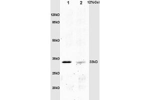 L1 mouse embryo lysates L2 mouse intestine lysates probed with Anti phospho-Crkl(Tyr251) Polyclonal Antibody, Unconjugated (ABIN703420) at 1:200 overnight at 4 °C. (CrkL 抗体  (pTyr251))