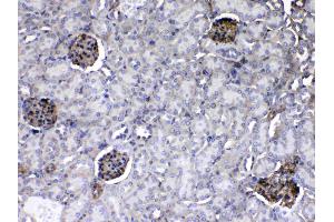 IHC analysis of Laminin using anti-Laminin antibody . (Laminin gamma 1 抗体  (all Isoforms))