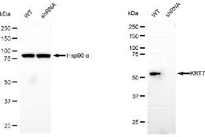 Western blotting analysis using keratin 7 antibody (ABIN7799187). (Recombinant Cytokeratin 7 抗体)