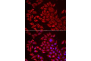 Immunofluorescence analysis of HeLa cell using AGPAT2 antibody. (AGPAT2 抗体)