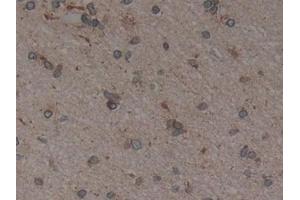 Immunohistochemistry (IHC) image for anti-Calnexin (CANX) (AA 239-461) antibody (ABIN7431509)
