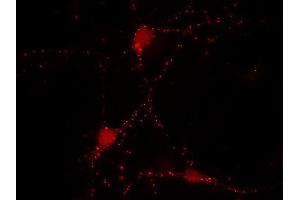 Indirect immunolabeling of cultured rat hippocampus neurons (dilution 1 : 500) (SYN2 抗体  (AA 440-458))