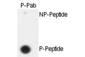 Dot blot analysis of ESPL1 (phospho S1126) polyclonal antibody  on nitrocellulose membrane. (Separase 抗体  (pSer1126))
