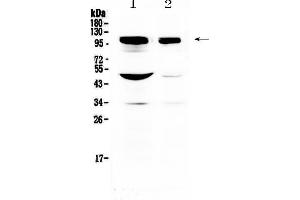 Western blot analysis of SAP102 using anti-SAP102 antibody . (DLG3 抗体  (AA 749-817))