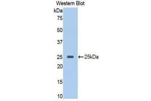 Western Blotting (WB) image for anti-serpin Peptidase Inhibitor, Clade A (Alpha-1 Antiproteinase, Antitrypsin), Member 10 (SERPINA10) (AA 278-425) antibody (ABIN1860973) (SERPINA10 抗体  (AA 278-425))