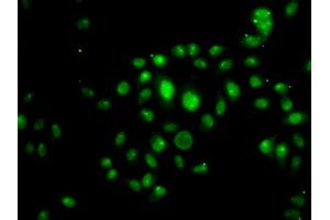 Immunofluorescence analysis of U2OS cells using HOXB7 antibody (ABIN5974166).