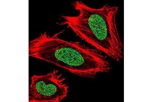 Immunofluorescence (IF) image for anti-Ubiquitin-Like, Containing PHD and RING Finger Domains, 1 (UHRF1) antibody (ABIN3003938) (UHRF1 抗体)