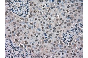 Image no. 1 for anti-Transmembrane Protein 100 (TMEM100) antibody (ABIN1501422) (TMEM100 抗体)