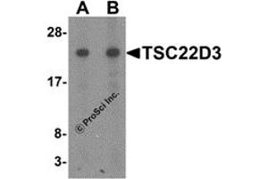 Western Blotting (WB) image for anti-TSC22 Domain Family, Member 3 (TSC22D3) (N-Term) antibody (ABIN1077436) (TSC22D3 抗体  (N-Term))