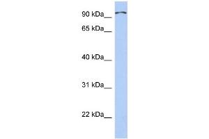Western Blotting (WB) image for anti-Transient Receptor Potential Cation Channel, Subfamily C, Member 4 Associated Protein (TRPC4AP) (Middle Region) antibody (ABIN2786140)