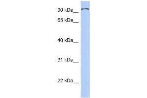 WB Suggested Anti-TRPC4AP Antibody Titration: 0. (TRPC4AP 抗体  (Middle Region))