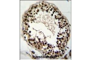 Immunohistochemistry (Paraffin-embedded Sections) (IHC (p)) image for anti-KH-Type Splicing Regulatory Protein (KHSRP) (AA 470-498) antibody (ABIN6243242)
