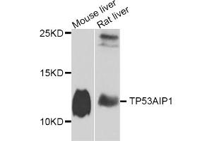 Western blot analysis of extracts of various cell lines, using TP53AIP1 antibody (ABIN5975103) at 1/1000 dilution. (TP53AIP1 抗体)