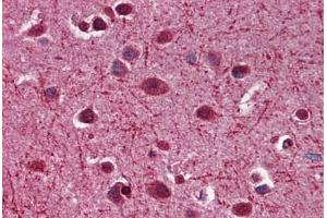 Human Brain, Cortex: Formalin-Fixed, Paraffin-Embedded (FFPE) (MAG 抗体  (AA 119-209))