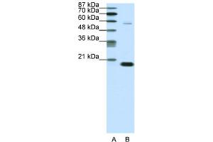 WB Suggested Anti-CBX3 Antibody Titration:  0. (CBX3 抗体  (Middle Region))
