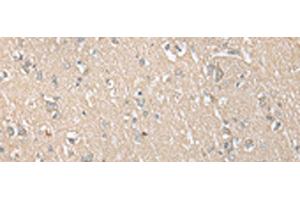 Immunohistochemistry of paraffin-embedded Human brain tissue using ECI1 Polyclonal Antibody at dilution of 1:30(x200) (DCI 抗体)