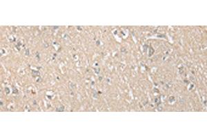 Immunohistochemistry of paraffin-embedded Human brain tissue using ECI1 Polyclonal Antibody at dilution of 1:30(x200) (DCI 抗体)