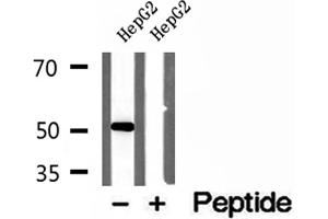 Western blot analysis of extracts of HepG2 cells, using NAPRT1 antibody. (NAPRT1 抗体  (Internal Region))