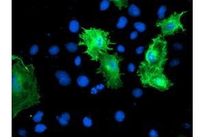 Anti-CNN2 mouse monoclonal antibody (ABIN2455129) immunofluorescent staining of COS7 cells transiently transfected by pCMV6-ENTRY CNN2 (RC221104). (CNN2 抗体)
