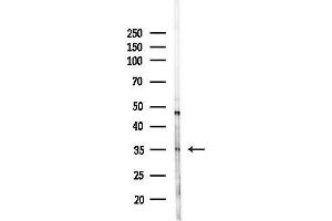 Western blot analysis of lysates from HepG2 cells(LPS, 4h treatment), using C1QTNF9B Antibody at 1/1000 dilution. (C1QTNF9B 抗体  (Internal Region))
