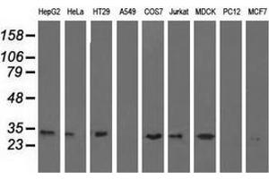Western blot analysis of extracts (35 µg) from 9 different cell lines by using anti-ERCC1 monoclonal antibody. (ERCC1 抗体)