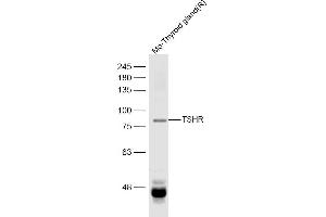 Thyroid gland(R) lysates probed with TSHR Polyclonal Antibody, Unconjugated  at 1:500 dilution and 4˚C overnight incubation.