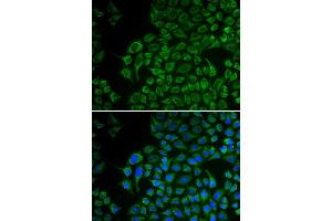 Immunofluorescence analysis of U2OS cell using TYR antibody. (TYR 抗体)