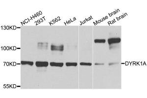 Western blot analysis of extracts of various cell lines, using DYRK1A antibody. (DYRK1A 抗体  (AA 624-763))