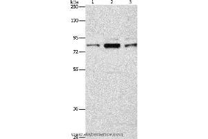 Western blot analysis of Human brain malignant glioma tissue, A172 and 293T cell, using ARHGEF7 Polyclonal Antibody at dilution of 1:800 (ARHGEF7 抗体)