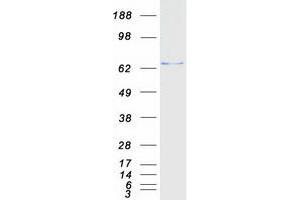 Western Blotting (WB) image for Ectodermal-Neural Cortex 1 (With BTB-Like Domain) (ENC1) protein (Myc-DYKDDDDK Tag) (ABIN2720165)