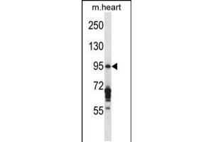 Western blot analysis in mouse heart tissue lysates (35ug/lane). (EXOC6B 抗体  (C-Term))