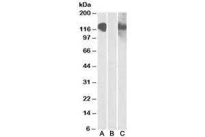 Western blot testing of HEK293 lysate overexpressing CDH11-MYC with CDH11 antibody [1ug/ml] in Lane A and with anti-MYC [1/1000] in lane C. (OB Cadherin 抗体)