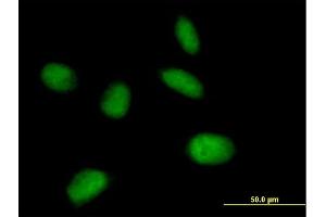 Immunofluorescence of purified MaxPab antibody to MIS12 on HeLa cell. (MIS12 抗体  (AA 1-205))