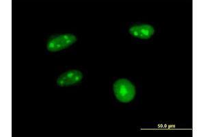 Immunofluorescence of purified MaxPab antibody to APTX on HeLa cell. (Aprataxin 抗体  (AA 1-254))
