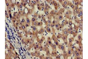 Immunohistochemistry of paraffin-embedded human liver tissue using ABIN7155985 at dilution of 1:100 (Hydroxyacid Oxidase 2 (HAO2) (AA 2-200) 抗体)