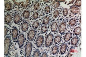 Immunohistochemistry (IHC) analysis of paraffin-embedded Human Colon, antibody was diluted at 1:100.
