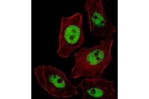 Fluorescent image of  cell stained with PHOX2B Antibody (Center) (ABIN655288 and ABIN2844878). (PHOX2B 抗体  (AA 104-130))