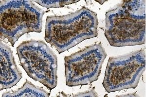 IHC analysis of RENT1/hUPF1 using anti-RENT1/hUPF1 antibody (ABIN7602979). (RENT1/UPF1 抗体  (Middle Region))