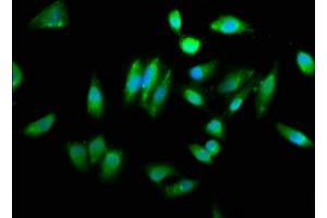 Immunofluorescence staining of Hela cells with ABIN7154130 at 1:260, counter-stained with DAPI. (CHAC1 抗体  (AA 43-264))