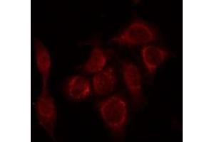ABIN6266732 staining HepG2 by IF/ICC. (PTTG1 抗体  (Internal Region))