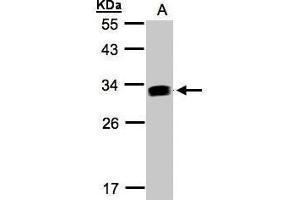 WB Image Sample(30 ug whole cell lysate) A:Raji , 12% SDS PAGE antibody diluted at 1:1000 (IFI30 抗体  (Center))
