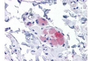 Immunohistochemistry (IHC) image for anti-Stromal Interaction Molecule 1 (STIM1) (AA 24-686) antibody (ABIN614666) (STIM1 抗体  (AA 24-686))