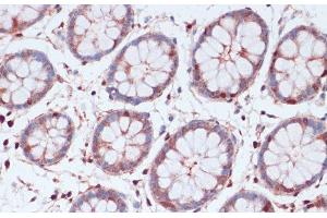 Immunohistochemistry of paraffin-embedded Human colon using S100A5 Polyclonal Antibody at dilution of 1:100 (40x lens). (S100A5 抗体)